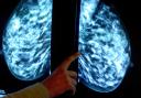 The hormonal coil may be linked to increased risk of breast cancer, researchers say (Rui Vieira/PA)