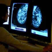 NHS breast screening uses X-rays, known as mammograms, to look for cancers that are too small to see or feel (Rui Vieira/PA)